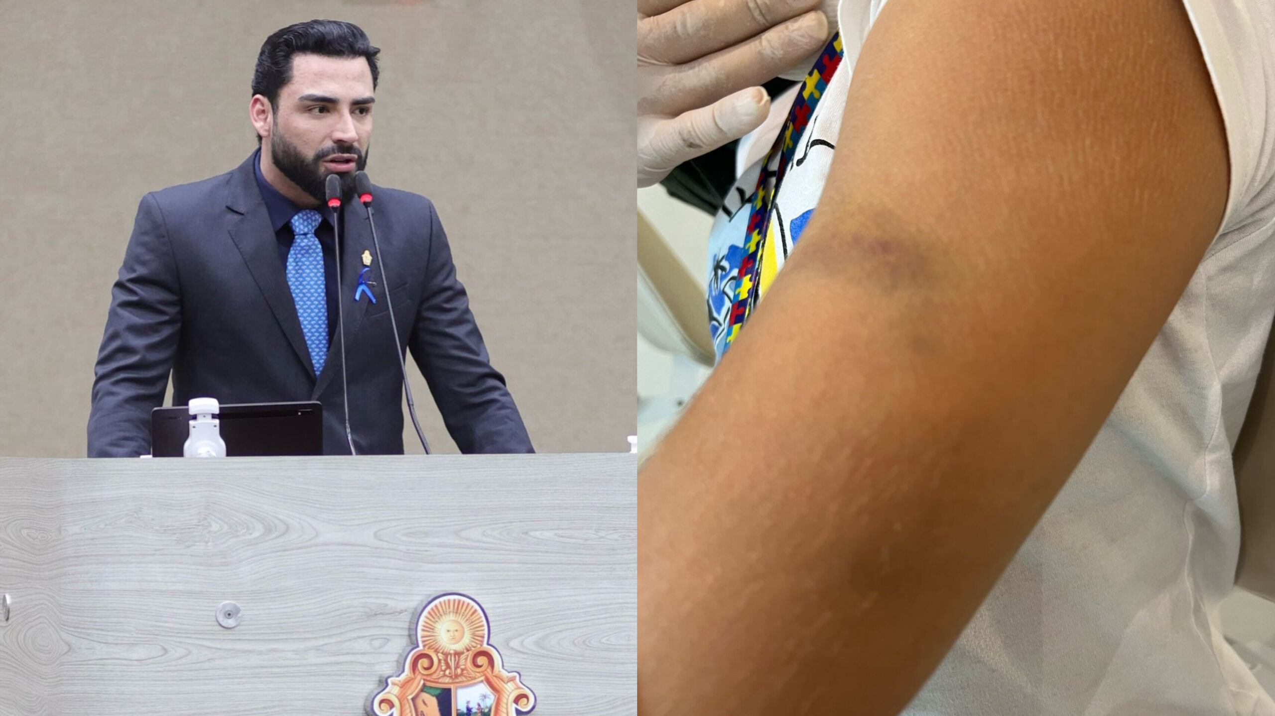 Eurico Tavares denuncia agressão de criança autista em escola particular de Manaus