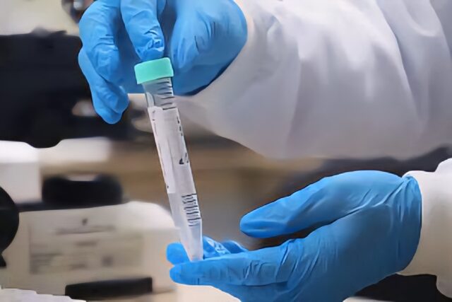 Casos de mpox caem 56% no Amazonas no primeiro quadrimestre de 2025