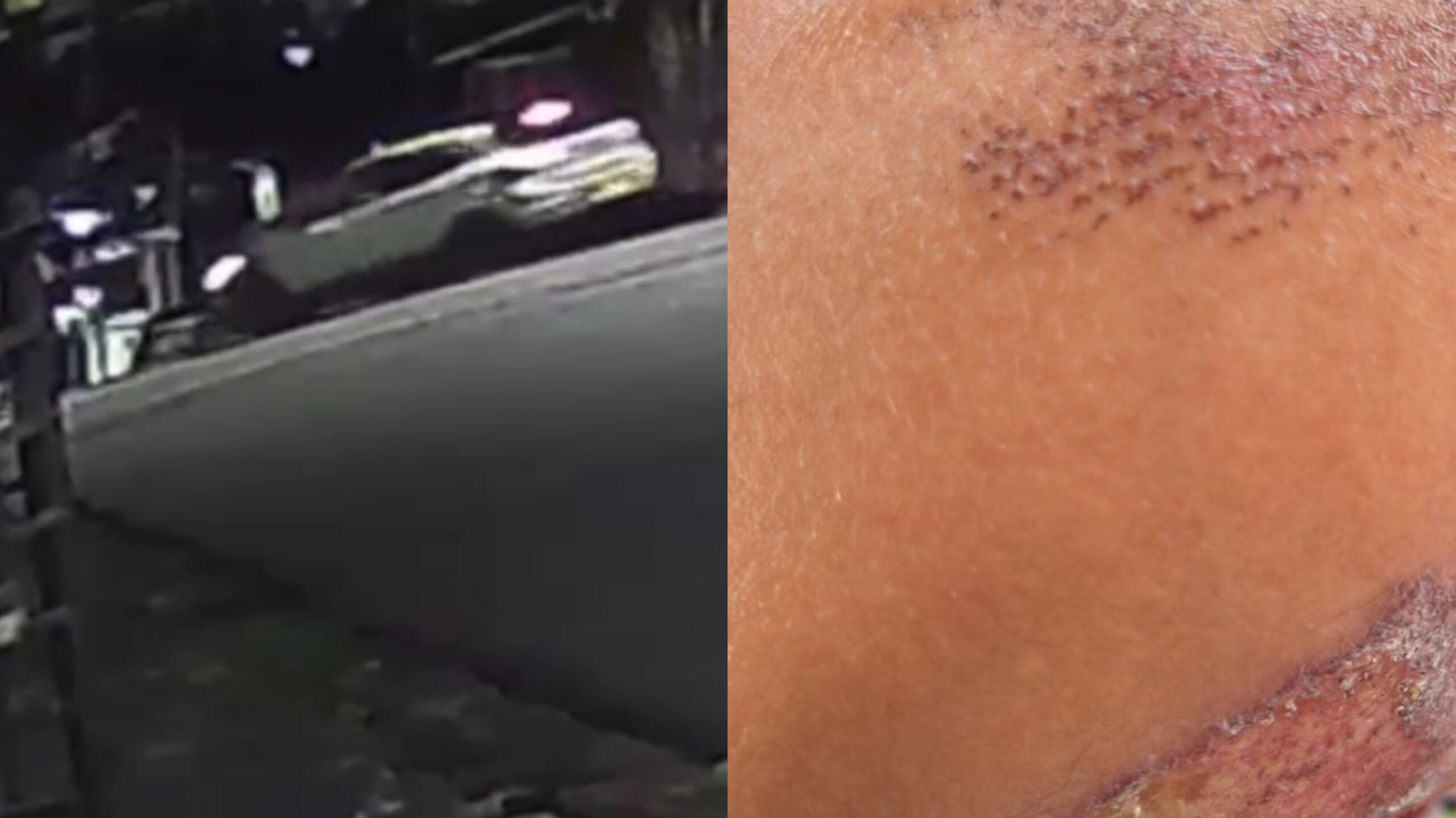 Mulher sofre ameaças e é vítima de atropelamento intencional pelo ex-companheiro em Manaus