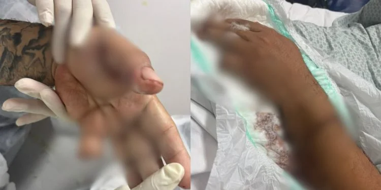 TERROR NO APP: Motorista é retalhado com terçado e atacado por Pitbull após corrida em Manaus