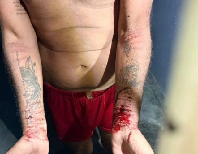 Cortes nos braços e tentativa de suicídio: O estado de Fernando Melo ao ser preso por matar o filho em Manaus 34 portal remador gFqQSPgl