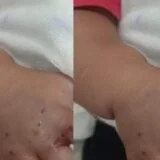 Drama em Maués: Bebê de 1 ano é picado por cobra e luta pela vida em hospital de Manaus