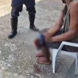 Homem tem três dedos amputados por facção e busca socorro na base do Samu na Compensa