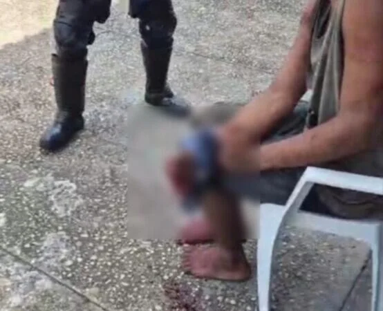Homem tem três dedos amputados por facção e busca socorro na base do Samu na Compensa